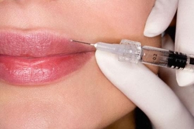Ботокс в устните - за онези, към които природата не е твърде щедра