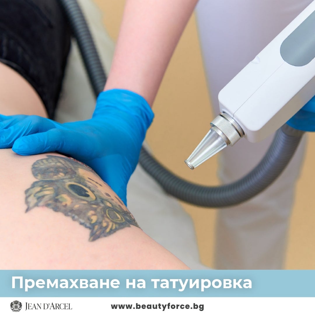 ПРЕМАХВАНЕ НА ТАТУИРОВКИ