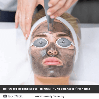 КАРБОНОВ ПИЛИНГ С NDYAG ЛАЗЕР