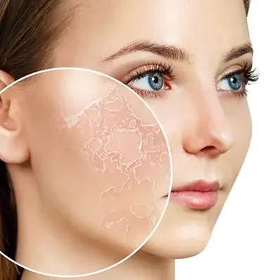 Суха, дехидратирана кожа