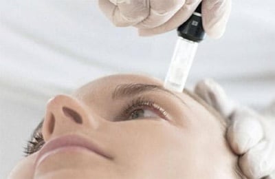 Естетична терапия с микроигли
